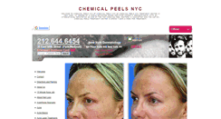 Desktop Screenshot of chemicalpeelsnyc.net