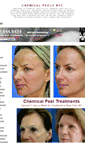 Mobile Screenshot of chemicalpeelsnyc.net