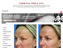 Tablet Screenshot of chemicalpeelsnyc.net